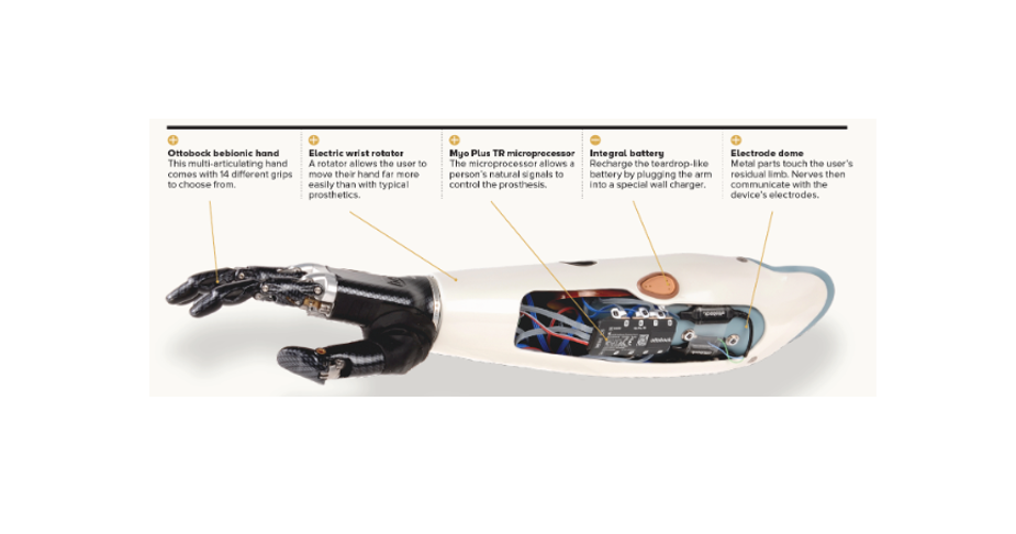 La biónica y su reto por restaurar el cuerpo humano