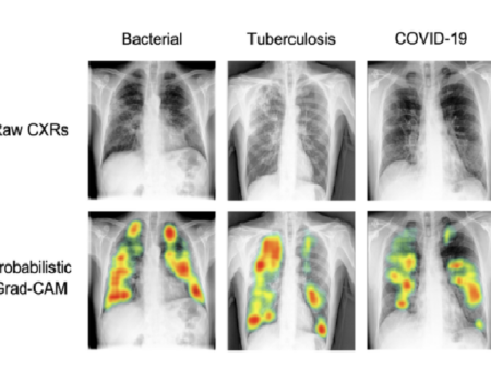 Optimización de un sistema de diagnóstico basado en IA para enfermedades infecciosas a través de procesamiento de datos médicos en Perú