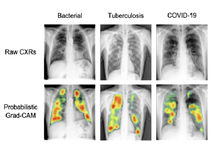 Optimización de un sistema de diagnóstico basado en IA para enfermedades infecciosas a través de procesamiento de datos médicos en Perú