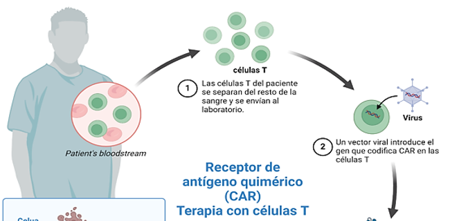 Car T cells therapy for autoimmune diseases